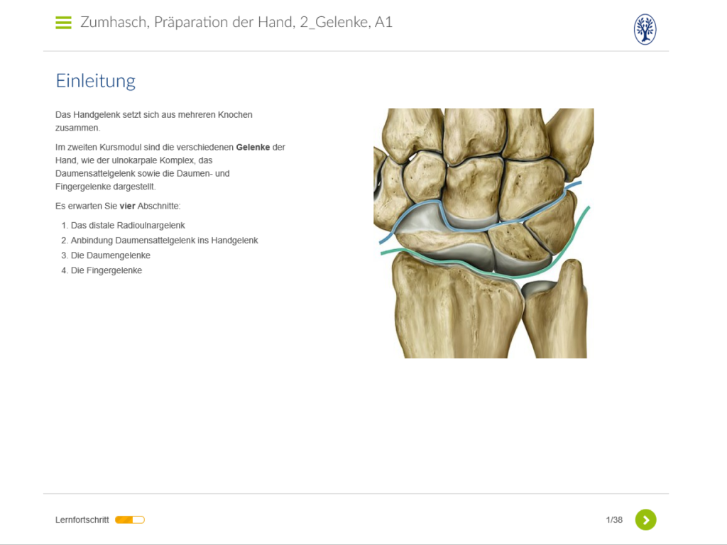 Präparation der Hand - 2. Gelenke