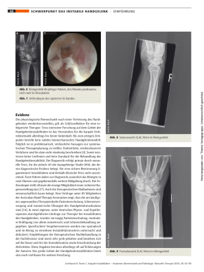 Karpale Instabilitäten – Anatomie, Biomechanik und Pathologie
