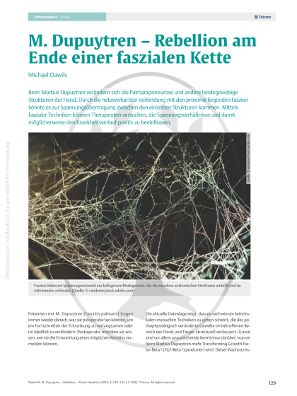 Morbus Dupuytren – Rebellion am Ende einer faszialen Kette