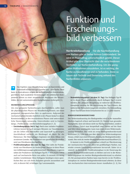 Narbenbehandlung | Funktion und Erscheinungsbild verbessern