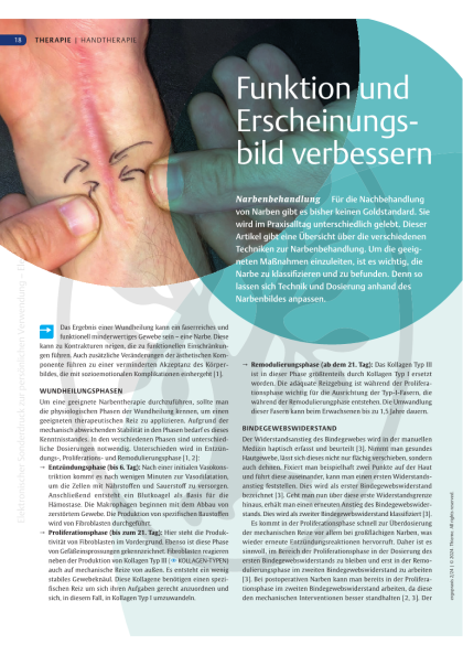 Narbenbehandlung | Funktion und Erscheinungsbild verbessern