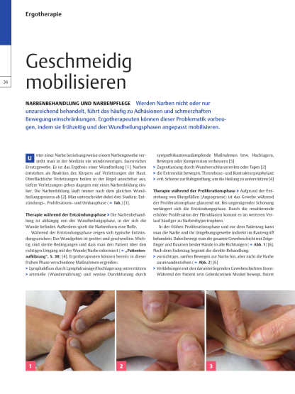 Narbenbehandlung und Narbenpflege | Geschmeidig mobilisieren