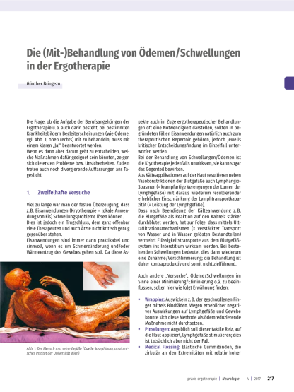 Ödeme und Schwellungen in der ergotherapeutischen Behandlung