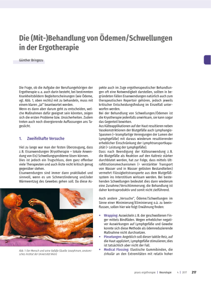Ödeme und Schwellungen in der ergotherapeutischen Behandlung