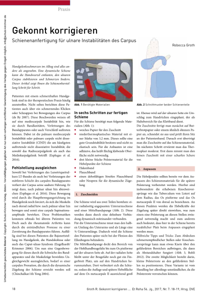 Schienenanfertigung für ulnare Instabilitäten des Carpus