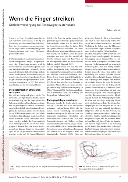 Schienenversorgung bei Tendovaginitis stenosans