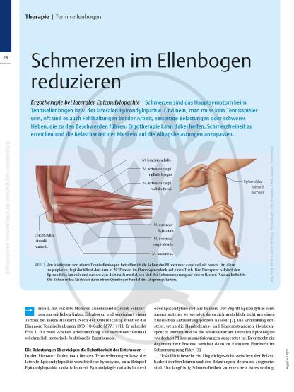 Schmerzen im Ellenbogen reduzieren