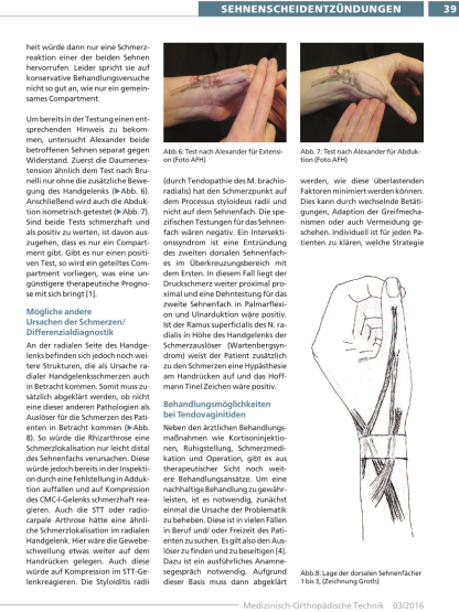 Sehnenscheidenentzündungen am Handgelenk erkennen und behandeln