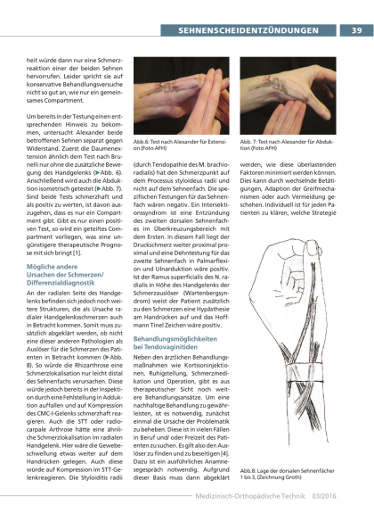 Sehnenscheidenentzündungen am Handgelenk erkennen und behandeln