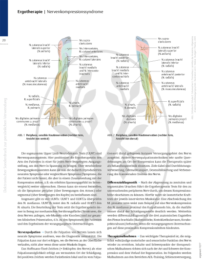 Wenn Nerven nerven – Nervenkompressionssyndrome, Teil 2