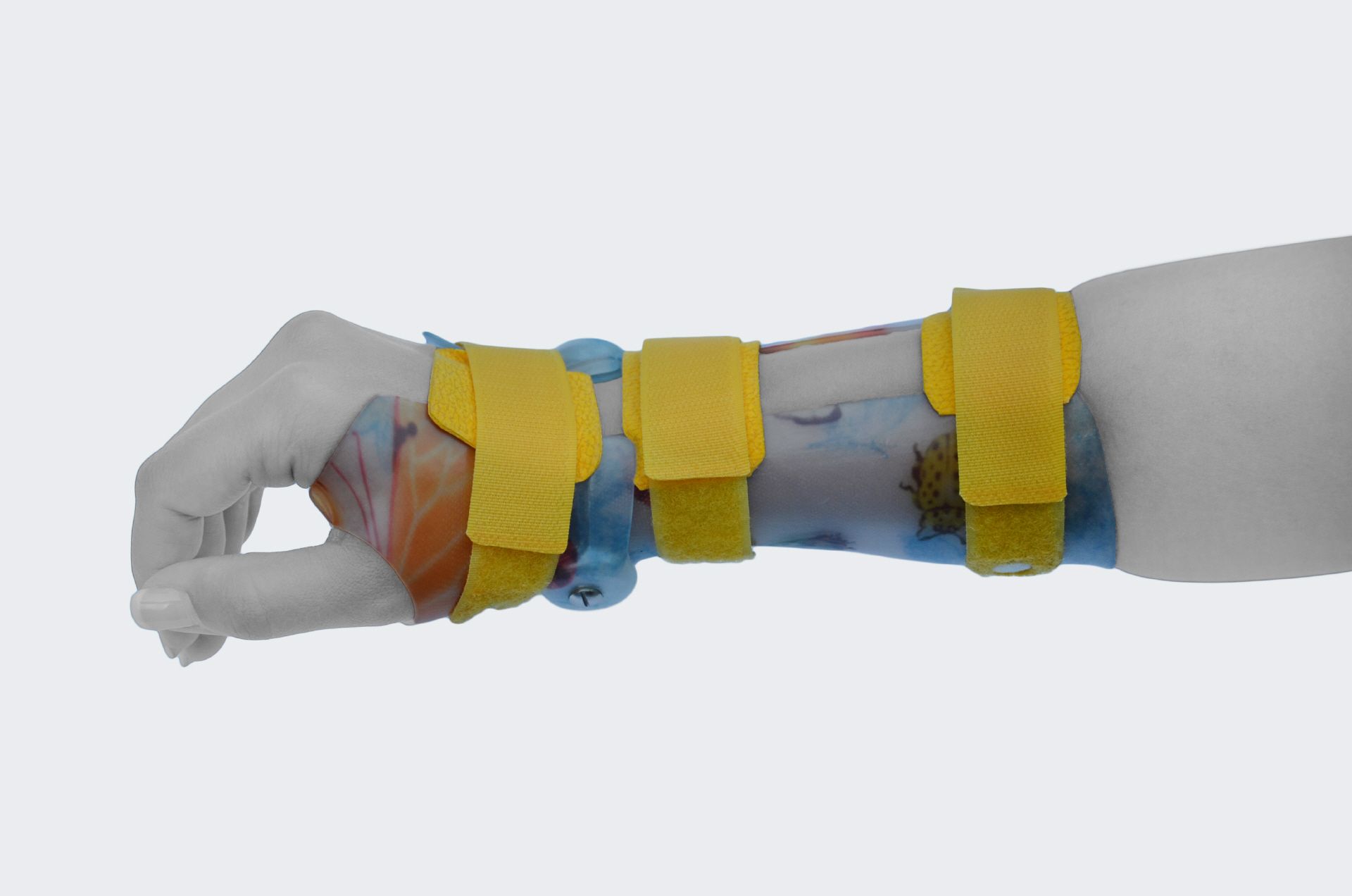 AFH DTM-Orthese am Handgelenk in seitlicher Ansicht