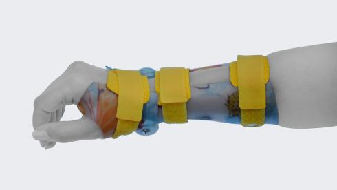 AFH DTM-Orthese am Handgelenk in seitlicher Ansicht