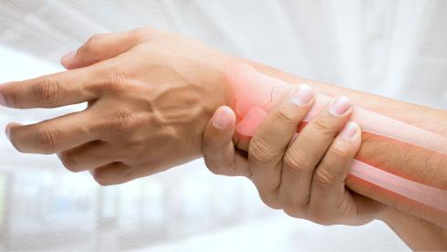 Handtherapie in der Rehabilitation – Weiterbildung für Ergo- und Physiotherapeuten