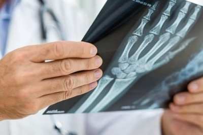 Forschung in der Handtherapie – wissenschaftliche Erkenntnisse für Ergo- und Physiotherapeuten