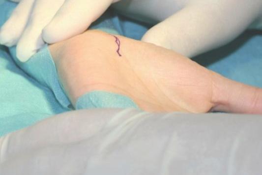 Präparation der Hand – anatomische Grundlagen für Weiterbildungen in der Handtherapie