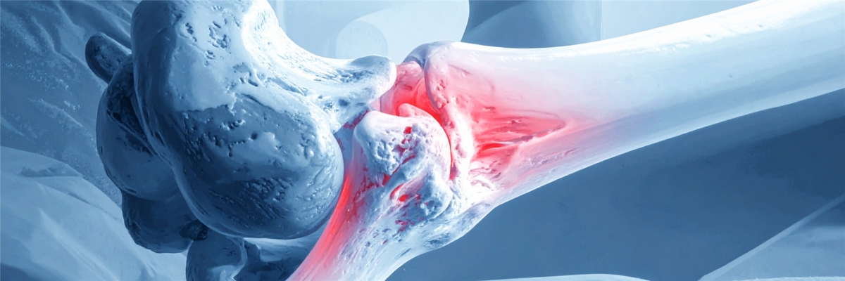 3D-gedruckte bioabbaubare Implantate unterstützen Knochenheilung