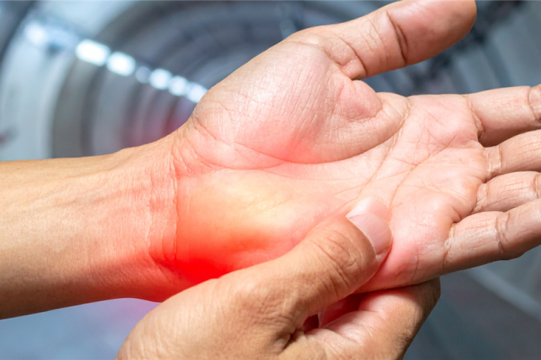 Studie: Berufliche Belastungen erhöhen das Risiko für Karpaltunnelsyndrom