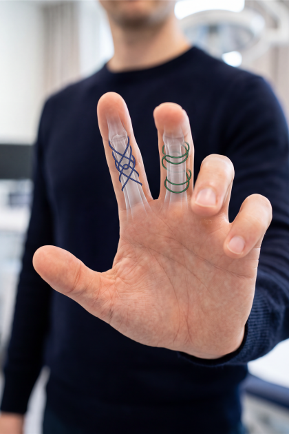Eine Männerhand mit einer grafischen Darstellung von zwei verschiedenen Sehnennahttechniken am Mittel- und Ringfinger.