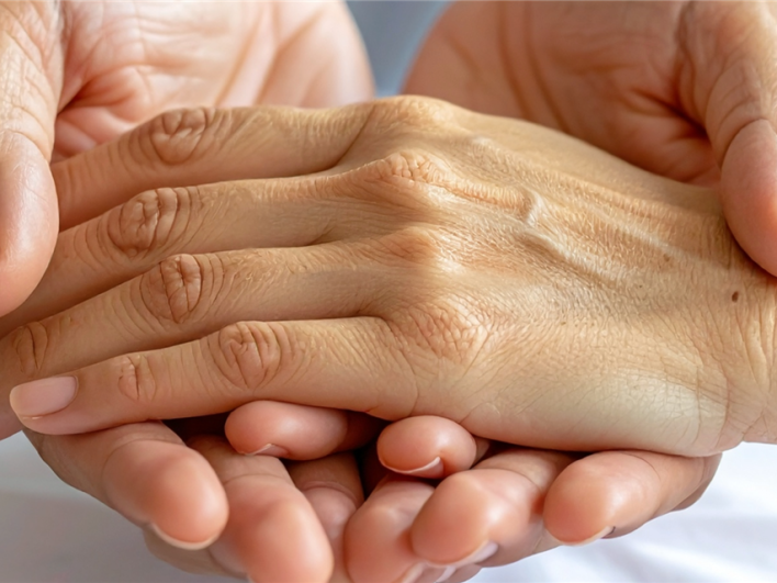 Psychosoziales Screening in der Handtherapie