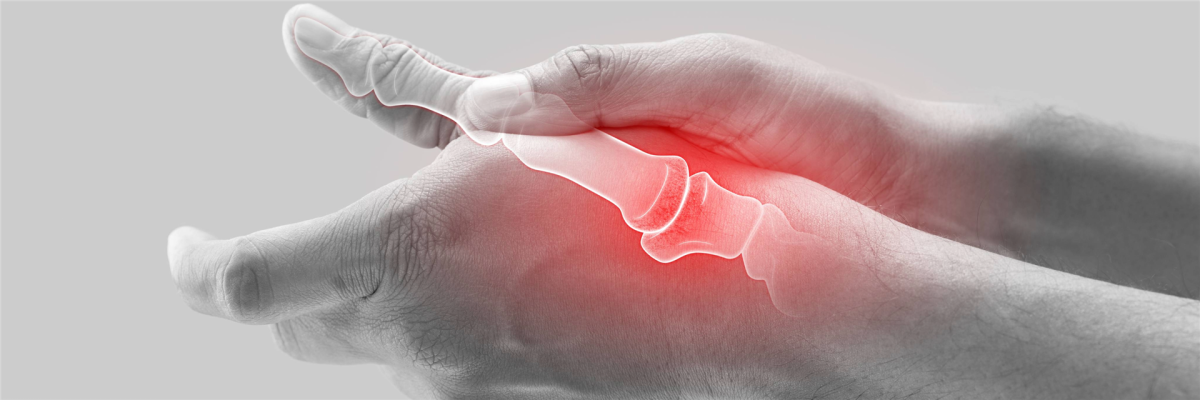 Rheumatoide Arthritis: Wenn die Gelenke betroffen sind – und das Denken mit